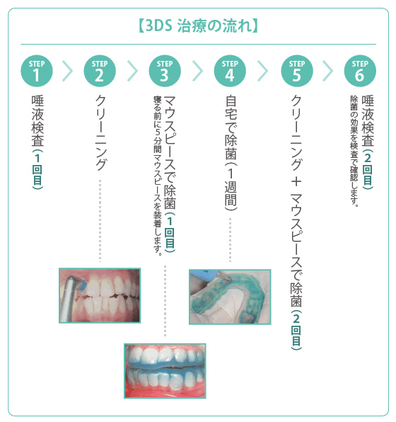 3DSの流れ